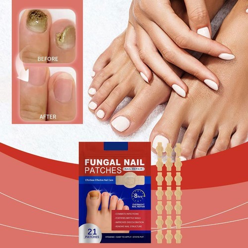 21-63xAnti Fungal Nail Treatment Patches Toe Fungus Onychomycosis Repair Sticker - Picture 2 of 18