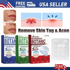 2026 New MICRONEEDLE BOTANIC Skin Tag  Acne Patch Skin Tag Remover Patches