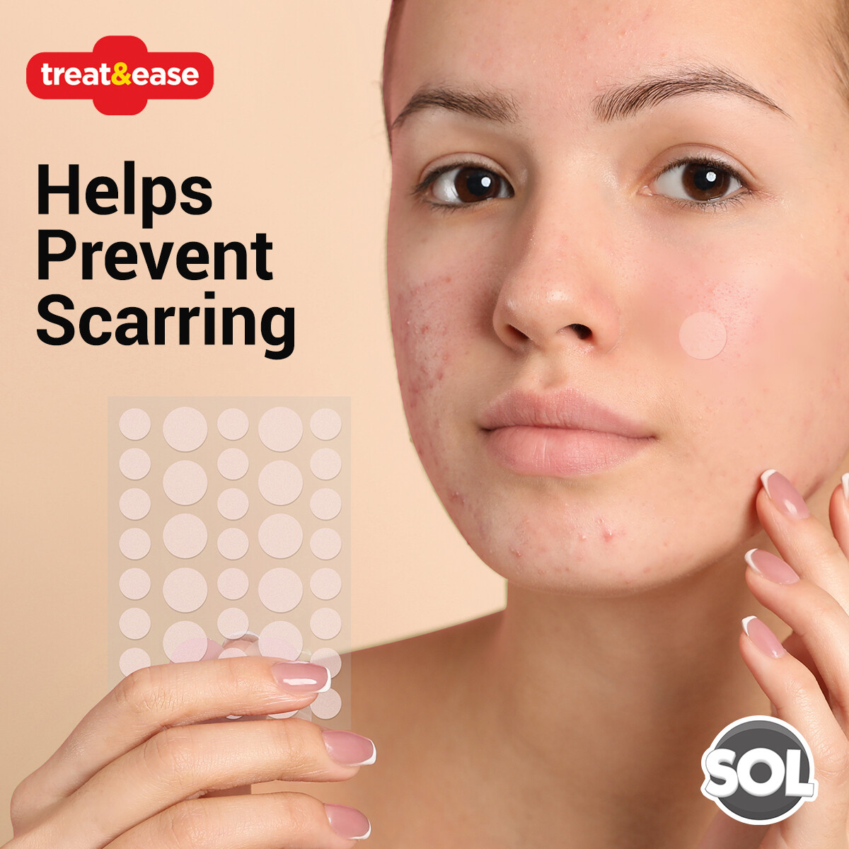 36 Cold Sore Patches Acne Spot Pimple Skin Breathable Blemish Hydrocolloid Patch 5056175900749