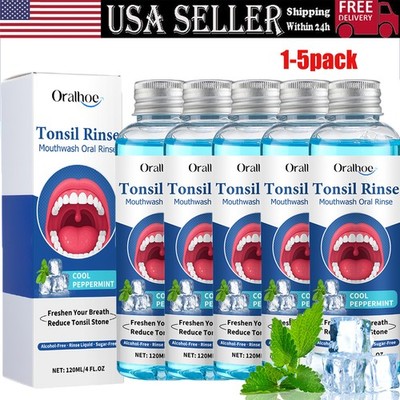 5/1X Natural Tonsil Stone Remover Rinse Mouthwash & Bad Breath Treatment 120ml