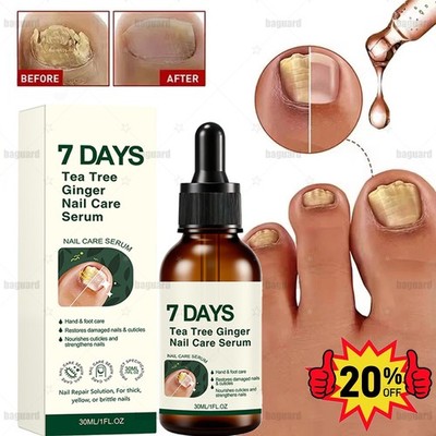 Tea Tree Ginger Nail Treatment Oil Thickened Nails Nail Repair Serum Nail Care