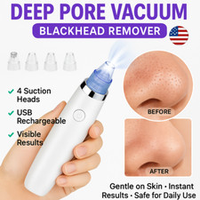 Eliminador de Espinillas Limpiador de Poros Succionador del Acn  Facial US