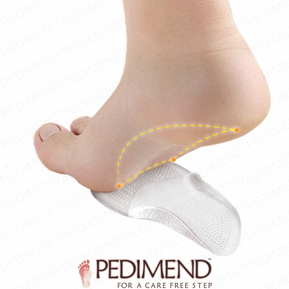 pedimend arch support