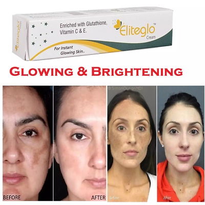 kojic acid glutathione skin brightening cream Eliteglo Cream For Whitening lightening Kojic acid Brightening CREAM 15g  Unisex