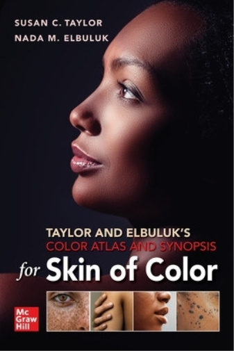 Susan Taylor Na Taylor and Elbuluk's Color Atlas and Synopsis for Sk (Tascabile)
