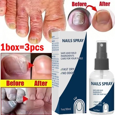 Blinzador Spray Nails Fingernails Long-Lasting Nutrition Toenail Care Supplies