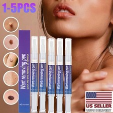 Skin Tag  Wart Remover Pen Painless Removes Common Plantar Warts Foot Corns 5ML