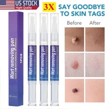 3 PACK Skin Tag Remover Pen Skin Tag Mole Wart Dark Spot Remover Painless Safe