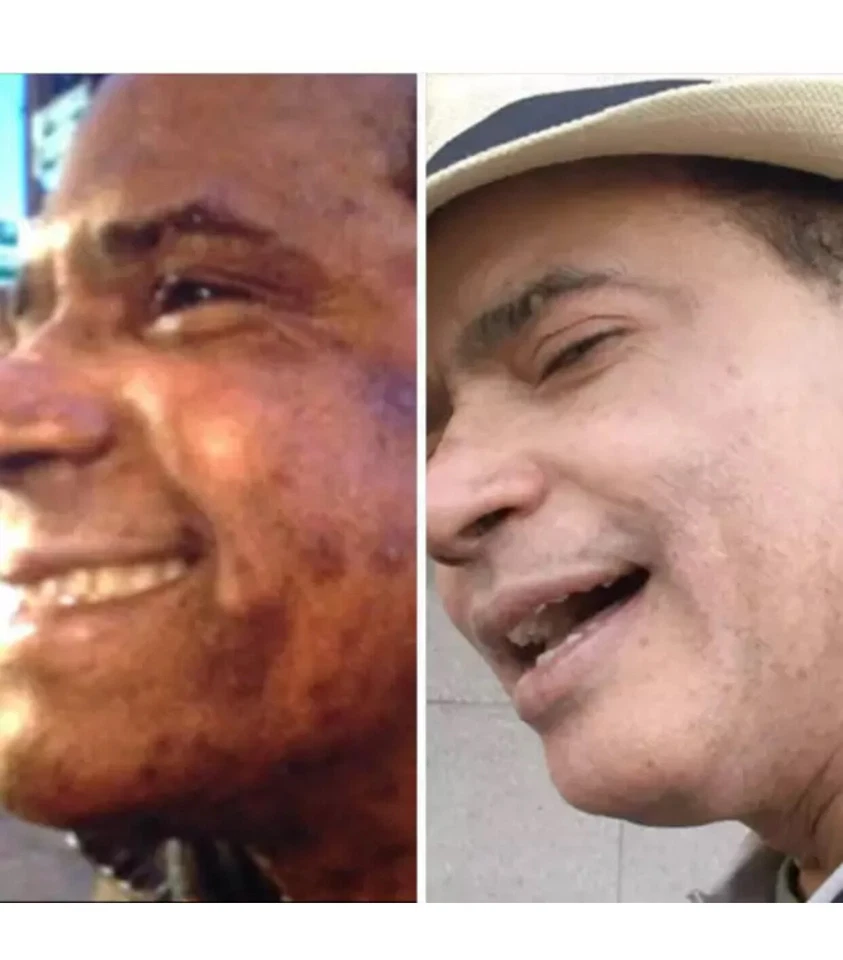 SKIN LIGHTENING TREATMENT: TRATAMIENTO EFECTIVO PARA BORRAR MANCHAS OSCURAS, 2oz - Image 4 of 4