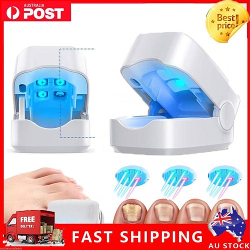 Nail Fungus Lasers Treatment Device Fingernail Toes Infections Remover