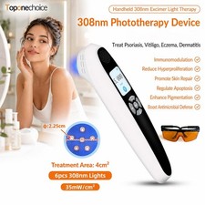UVB 308nm Light Therapy Device Excimer Phototherapy System Portable for Home Use