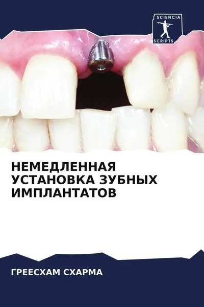 Greesham Sharma | Nemedlennaya Ustanovka Zubnyh Implantatov | Taschenbuch (2022)-image