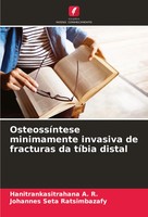 Hanitrankasitrahana A. R. (U. A.) | OsteossíNtese Minimamente Invasiva De...