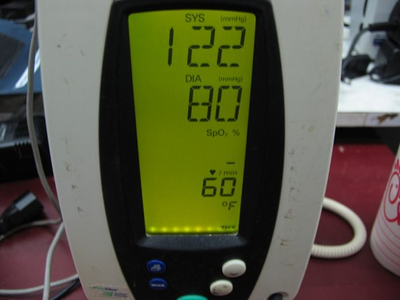 #ad WELCH ALLYN 420 SERIES SPOT VITAL SIGN MONITOR NIBP SPO2 TEMPERATURE BMET $200.00
