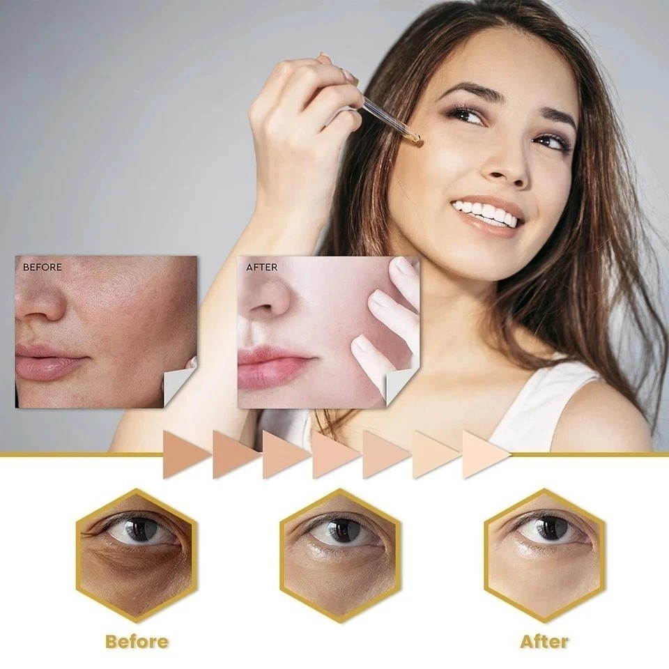 Skin Whitening Serum - Lighten Body Blemishes, Brighten Skin Tone, Protect Skin