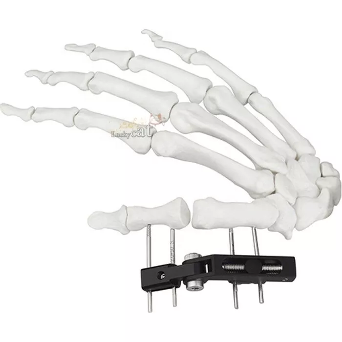 Ilizarov The Bone School