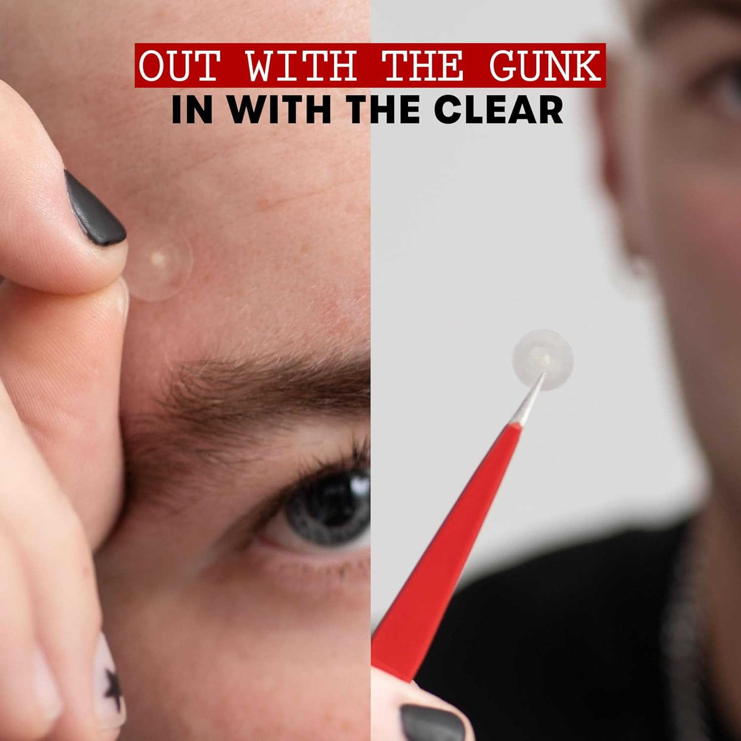 как выглядит Invisible S.O.S Hydrocolloid Acne Pimple Patch, Ultra-Thin Design Instantly Redu фото