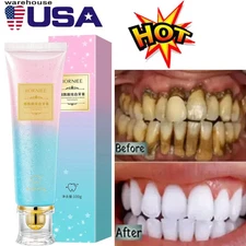 Niacinamide WhiteniUS Toothpaste,Natural Niacinamide Toothpaste,Teeth WhiteniDY