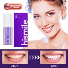 Hismile V34 Colour Corrector - Purple Teeth Whitening for Tooth Stain Removal