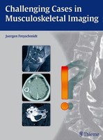 Challenging Cases In Musculoskeletal Imaging JüRgen Freyschmidt