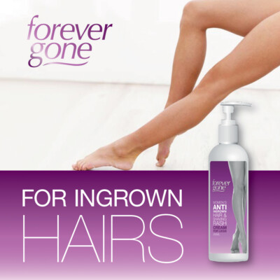 FOREVER GONE DAMEN ANTI EINGEWACHSENE CREME FÜR BEINE STOPPEN REIZUNGEN GLATT