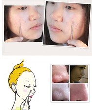 Blackhead Comedone Acne Pimple Blemish Extractor Remover Needles Tool