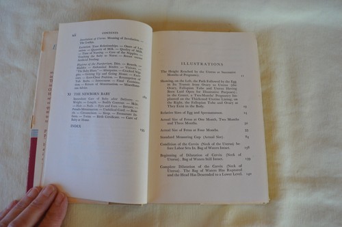 HCDJ Expectant Motherhood by Nicholson J Eastman 2nd Ed Revised 1947 Illustrated - Picture 12 of 18