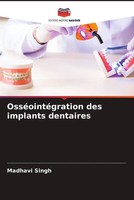 Madhavi Singh | OsséOintéGration Des Implants Dentaires | Taschenbuch (2023)