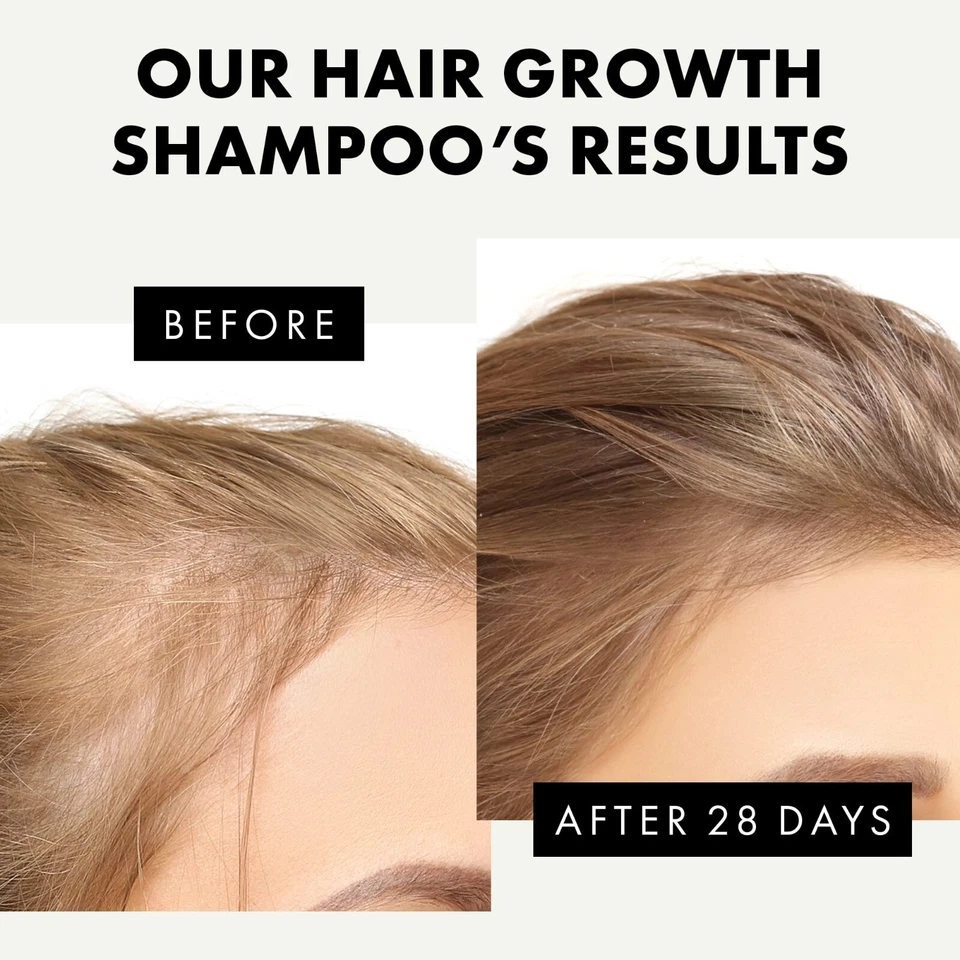 Biotin Infused Hair Loss Growth Therapy Shampoo & Conditioner / Paisle Botanix - Image 4 of 4