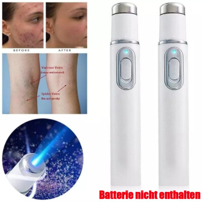 LCD Laser Plasma Pen Tag Tattoo Removal Mole Dark Spot Skin Wart Beauty Care DE.