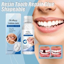 Teeth Glue For Loose Teeth Tooth Repair Beads For Broken Teeth Loose lovely