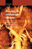 Pruritus In Advanced Disease Zbigniew Zylicz (U. A.) Taschenbuch Englisch 2004