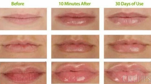 Sally Hansen Lip Inflation Plumping Treatment - 6690-15 Clear gloss - Image 3 of 3