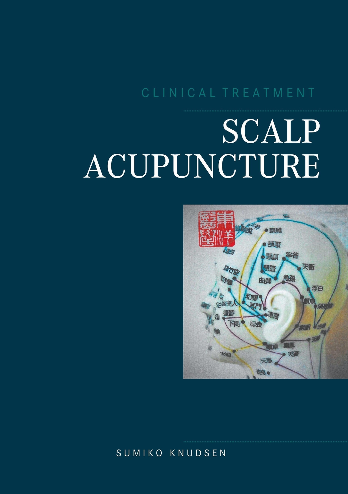 Thumbnail - Scalp Acupuncture Sumiko Knudsen Taschenbuch Paperback Englisch 2021