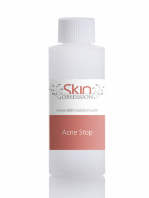 2 oz Acne Stop ~ Skin Obsession ~ Reduces Acne & Future Acne Outbreaks!
