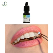 Professional Tooth Gem Rhinestone Placement Bond Step 2 - Stones Not Included