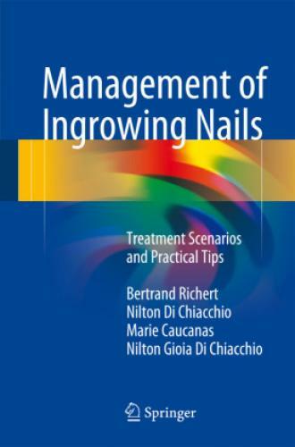 Thumbnail - Management Of Ingrowing Nails Treatment Scenarios And Practical Tips