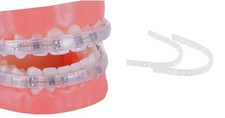 Protector for Braces, Orthodontic Mouth Guard, Wax Alternative, Comfort Covers,