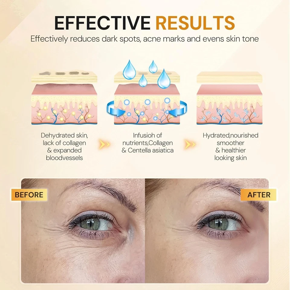 60шт 24K золото глаз маски коллаген под глаза пластыри для темных кругов (30 пар) - Изображение 4 из 4