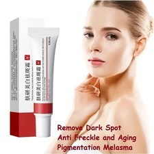 Dark Melasma Spot Removal Face Cream Whiten Cream Effective Brightening Cream