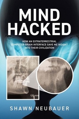 Mind Hacked: How an Extraterrestrial Computer-Brain Interface Gave Me Insight In