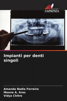 Amanda Nadia Ferreira (u. a.) | Impianti per denti singoli | Taschenbuch (2022)