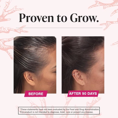 Viviscal Hair Growth Dietary Supplement with Collagen Complex 180 Tabs EXP:2027 - Picture 7 of 7