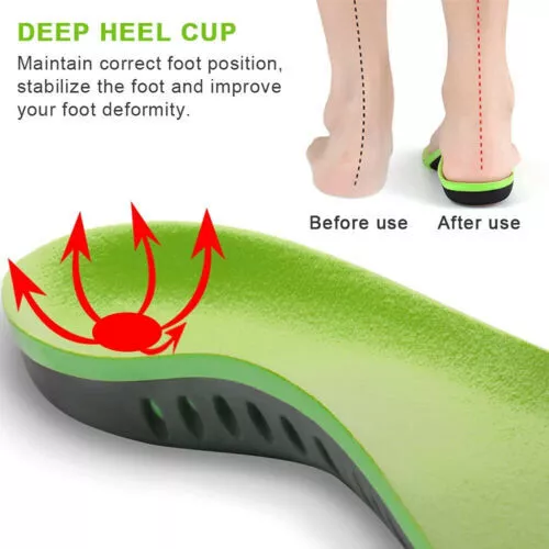 Orthotic Shoe Insoles Inserts-Flat Feet/High Arch Support for Plantar-Fasciitis - Picture 4 of 32