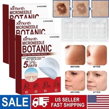 45 PCS Microneedle Botanic Skin Tag  Acne Patch Skin Tag Remover Patches HOT