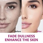 Arbutin 8% & Tranexamic Acid 5% Cream, Help Fade Dark Spots, Freckles, Blemishes
