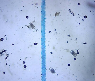 In Stool Under McMaster Method Microscope Slide, FEC Fecal Egg Count Or Worm Count Double Chamber Slide For 795694 - Foto 6