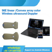 Portable Wireless Ultrasound Wifi/USB Connection 96E Color Linear/Convex Doppler