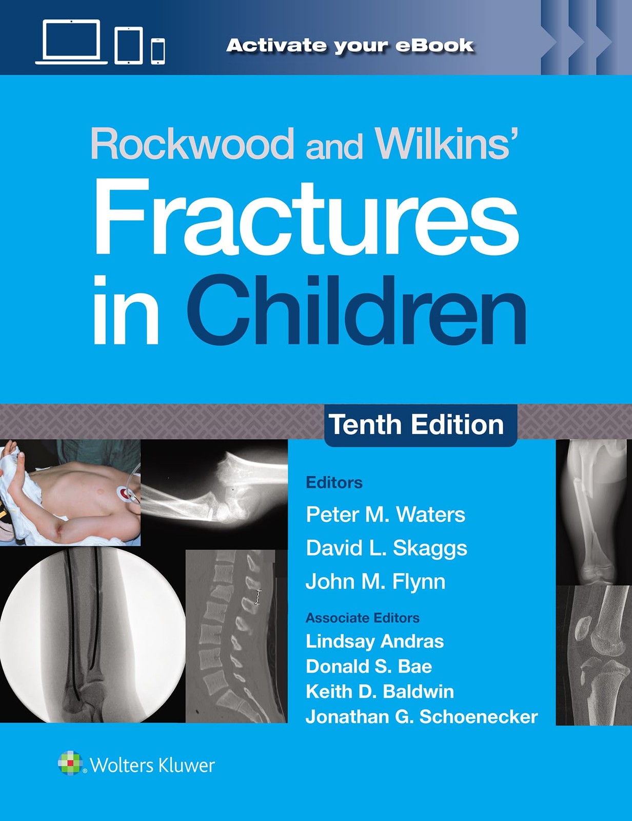 Rockwood and Wilkins' Fractures in Children. Skaggs 9781975211738 New**