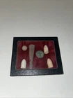 Vintage Virginia Dug Confederate Bayonet Scabbard Tip, Button , And 4 Bullets